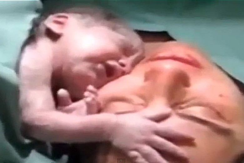 Bayi Baru Lahir Enggan Pisah dengan Sang Ibu
