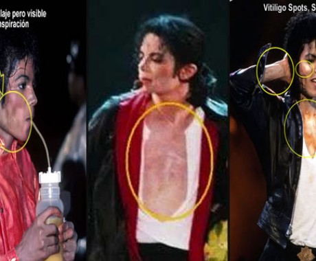 Kontroversi Kulit Michael Jackson