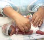 Berapa Usia Bayi Prematur?