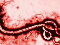 Waduh, Ebola Sampai ke Australia?