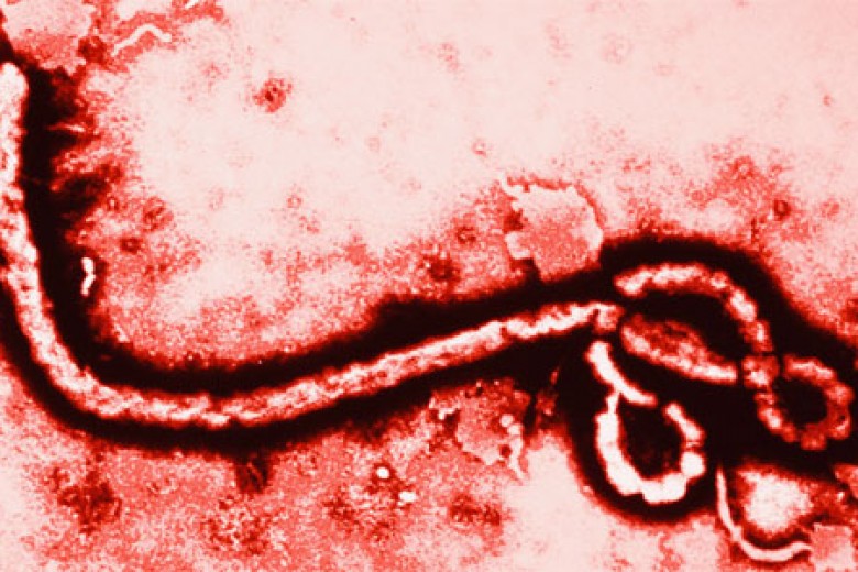 Waduh, Ebola Sampai ke Australia?