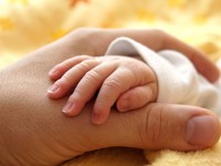 RSCM Pisahkan Bayi Kembar Dempet Panggul
