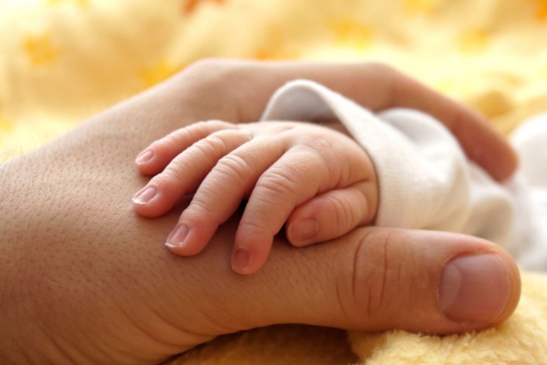 RSCM Pisahkan Bayi Kembar Dempet Panggul