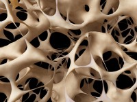Bagaimana Osteoporosis Muncul?